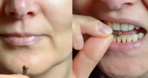 Chewing Cloves Daily: A Tiny Habit with Massive Health Benefits